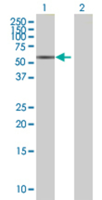 Lane 1: MLKL transfected lysate (51.92 KDa) Lane 2: Non-transfected lysate.