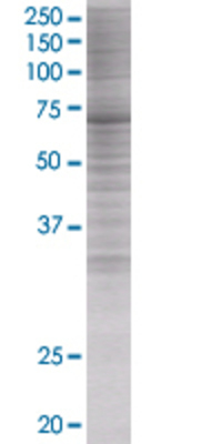 NUP98 transfected lysate.