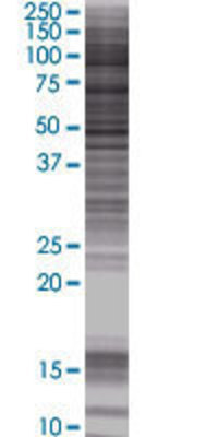 RHBDL2 transfected lysate.