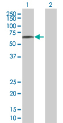 Lane 1: CBS transfected lysate (60.6 KDa) Lane 2: Non-transfected lysate.