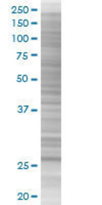 VENTX transfected lysate.