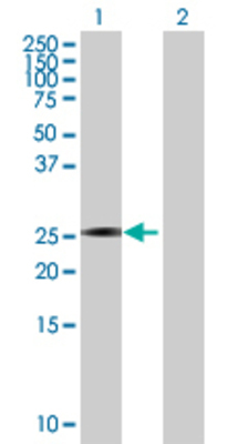 Lane 1: VENTX transfected lysate (28.49 KDa) Lane 2: Non-transfected lysate.