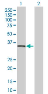Lane 1: FTS transfected lysate (33.1 KDa). Lane 2: Non-transfected lysate.