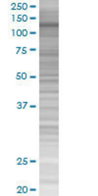 MICAL1 transfected lysate.