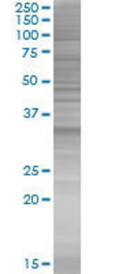 NKX2-8 transfected lysate.