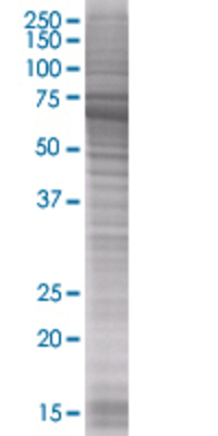 LCP2 transfected lysate