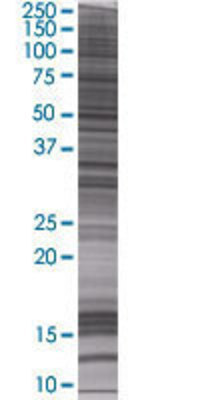 CA5B transfected lysate.