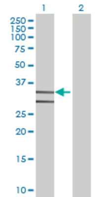 Lane 1: CA5B transfected lysate (34.98 KDa) Lane 2: Non-transfected lysate.