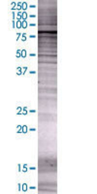 RHOBTB1 transfected lysate.