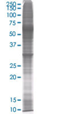 GNPDA1 transfected lysate