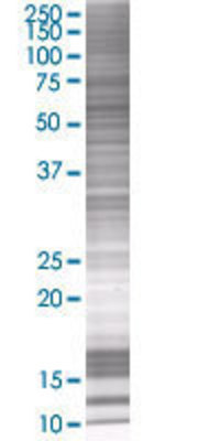 TTC8 transfected lysate.