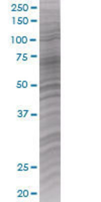 CD69 transfected lysate.