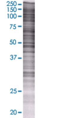 GAK transfected lysate.