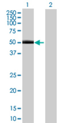Lane 1: GAK transfected lysate (45.87 KDa) Lane 2: Non-transfected lysate.