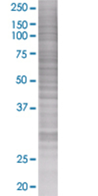 CDC25B transfected lysate.