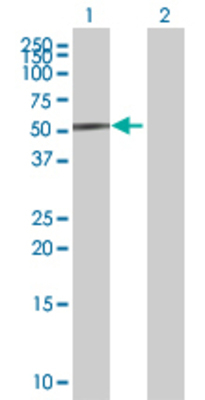 Lane 1: BRE transfected lysate (47 KDa) Lane 2: Non-transfected lysate.