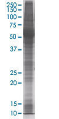CCNE1 transfected lysate