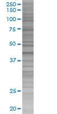 MEF2B transfected lysate.
