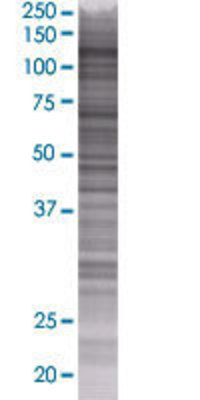 BUB1B transfected lysate.