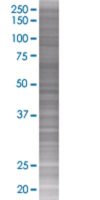 DFFA transfected lysate