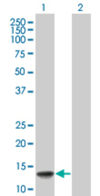 Lane 1: VAMP8 transfected lysate (11 KDa) Lane 2: Non-transfected lysate.