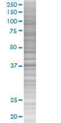 UROD transfected lysate.
