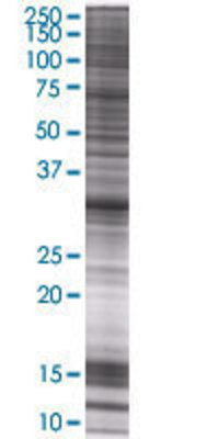 STX11 transfected lysate.