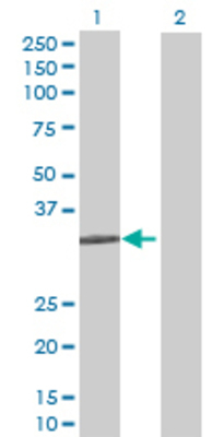 Lane 1: STX11 transfected lysate (31.68 KDa) Lane 2: Non-transfected lysate.