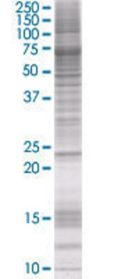 MYL3 transfected lysate.