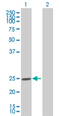 Lane 1: MYL3 transfected lysate (21.9 KDa) Lane 2: Non-transfected lysate.