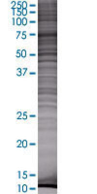 ASRGL1 transfected lysate.