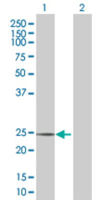 Lane 1: PPP1CB transfected lysate (37.2 KDa) Lane 2: Non-transfected lysate.