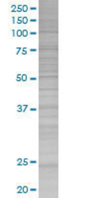 PPP1CB transfected lysate.