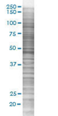 PSRC2 transfected lysate.