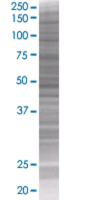 NOLC1 transfected lysate.