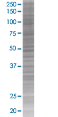 RBBP6 transfected lysate