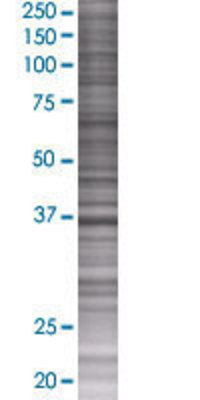 FBXL8 transfected lysate.