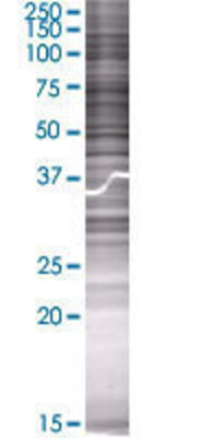 LIPG transfected lysate.