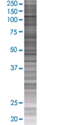 PASD1 transfected lysate.