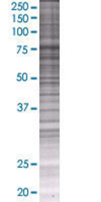 LIMK2 transfected lysate.