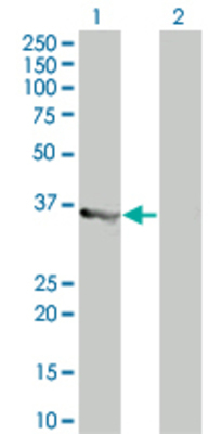 Lane 1: MYD88 transfected lysate (32.67 KDa) Lane 2: Non-transfected lysate.