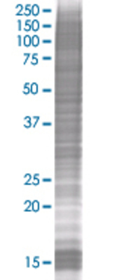 MYD88 transfected lysate.