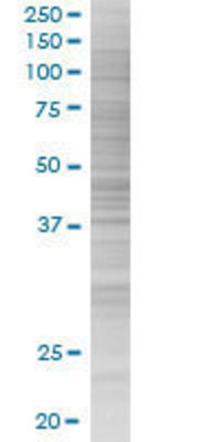 HYAL3 transfected lysate.