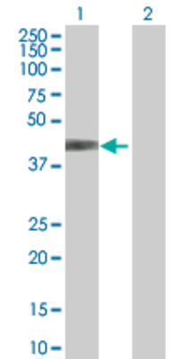 Lane 1: SORD transfected lysate (38.3 KDa) Lane 2: Non-transfected lysate.