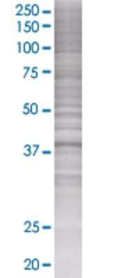 SORD transfected lysate.