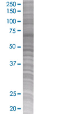 IFNB1 transfected lysate