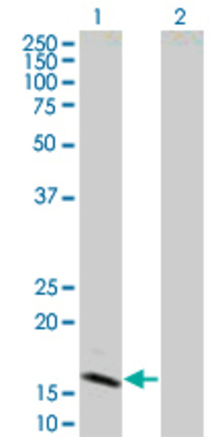 Lane 1: IFNB1 transfected lysate (22.3 KDa). Lane 2: Non-transfected lysate.