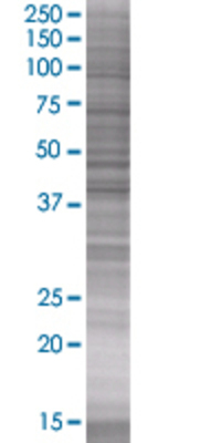 GNAQ transfected lysate