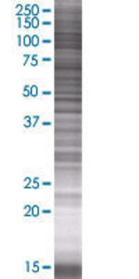 GUCA2B transfected lysate.