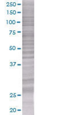 VEGFB transfected lysate.